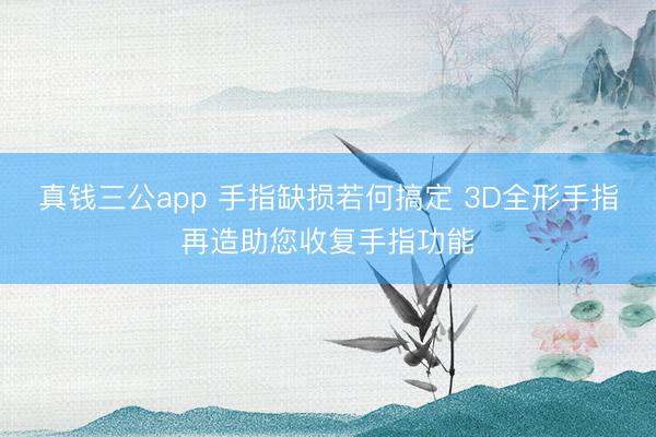 真钱三公app 手指缺损若何搞定 3D全形手指再造助您收复手指功能
